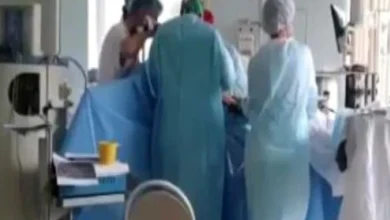 60 मिनट में निकलीं 8125 पथरियां, गिनने में लगे 6 घंटे – दिल्ली-NCR का अनोखा मेडिकल केस