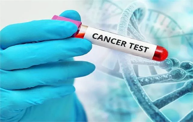 सावधान! महिलाओं को चुपचाप निगल रहा है ये ‘साइलेंट किलर’ कैंसर — क्या आप