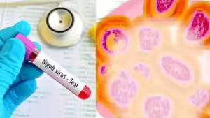 बंगाल में ‘निपाह’ की दस्तक? 2 नए संदिग्ध मिलने से मचा हड़कंप, अलर्ट पर स्वास्थ्य विभाग